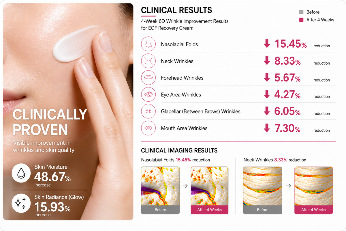 EGF Recovery Cream – 55 mL